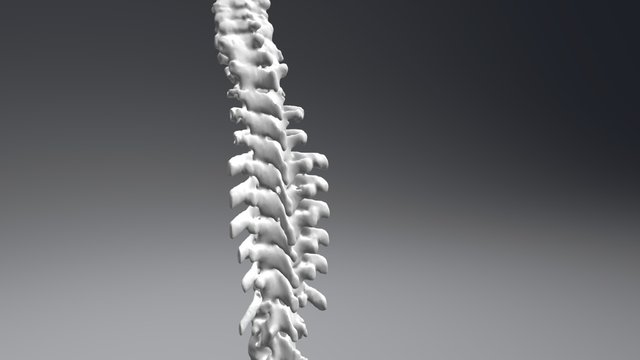 Full-sized patient-specific spine from CT 3D Model