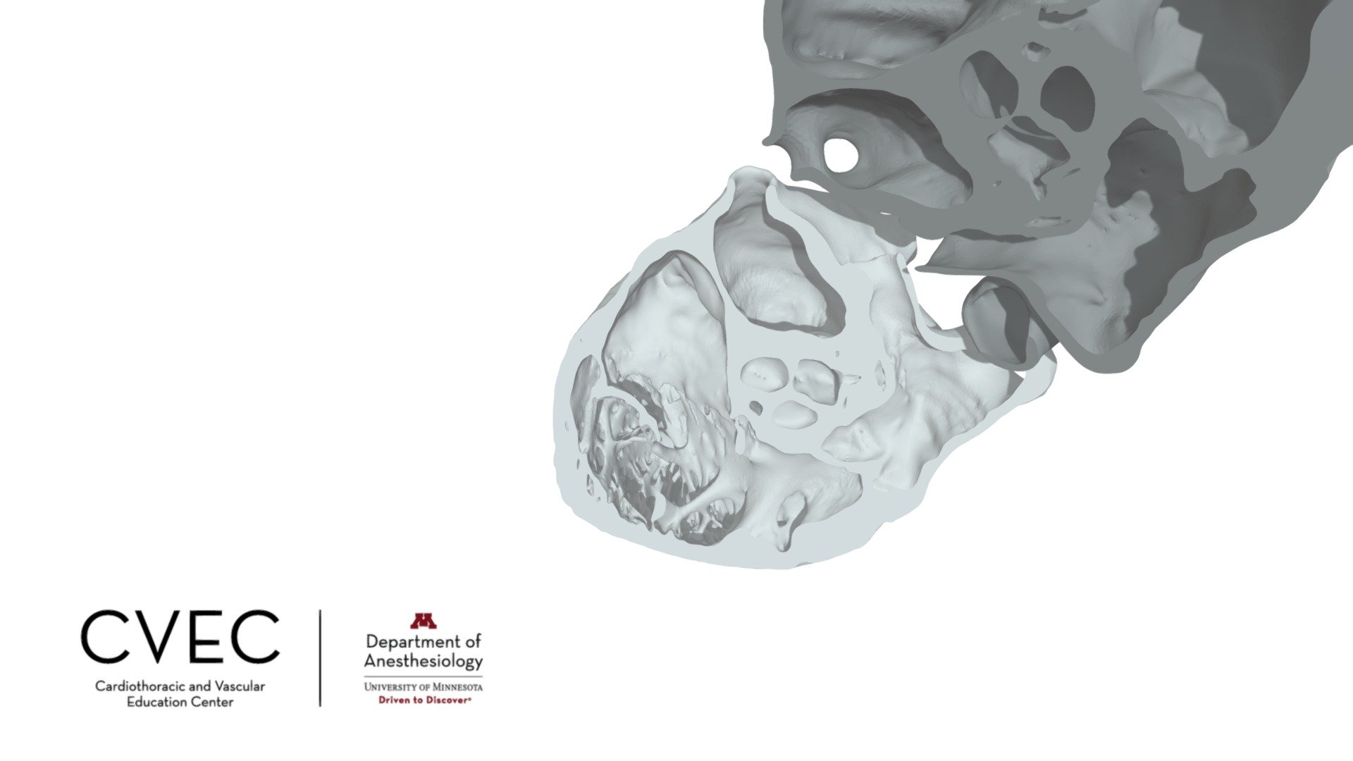 TEE Right Ventricle Inflow-Outflow - 3D model by CVEC [6780653] - Sketchfab