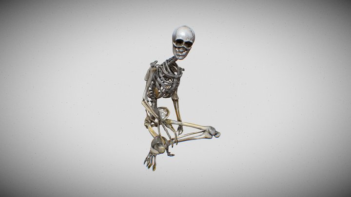 ESQUELETO CON LA ENFERMEDAD ACROMEGALIA 3D Model