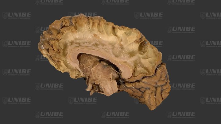 Cuerpo calloso vista medial 3D Model