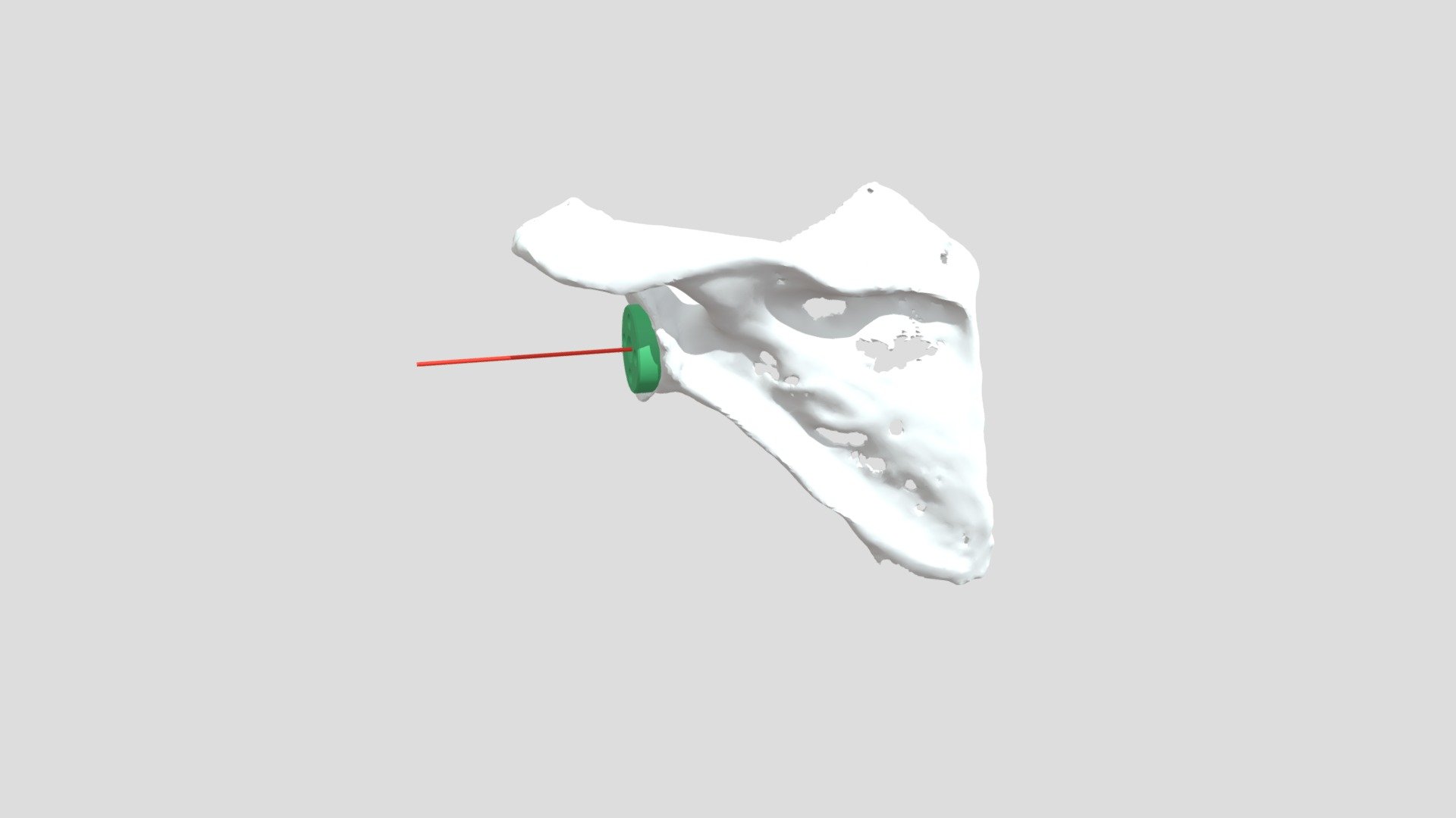 Techimport Planejamento SEM enxerto