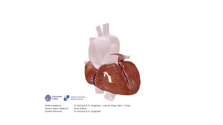 Bicuspid Aortic Valve (BAV)