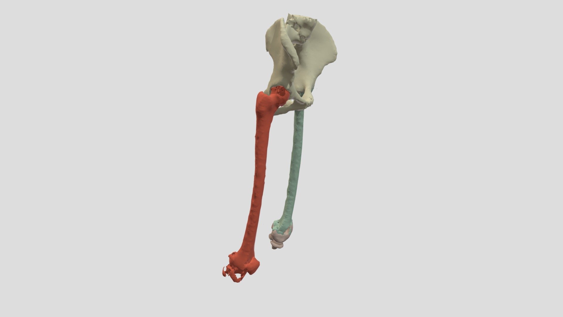 Pelvis, Femurs, and Artificial Knee - Download Free 3D model by schwig ...