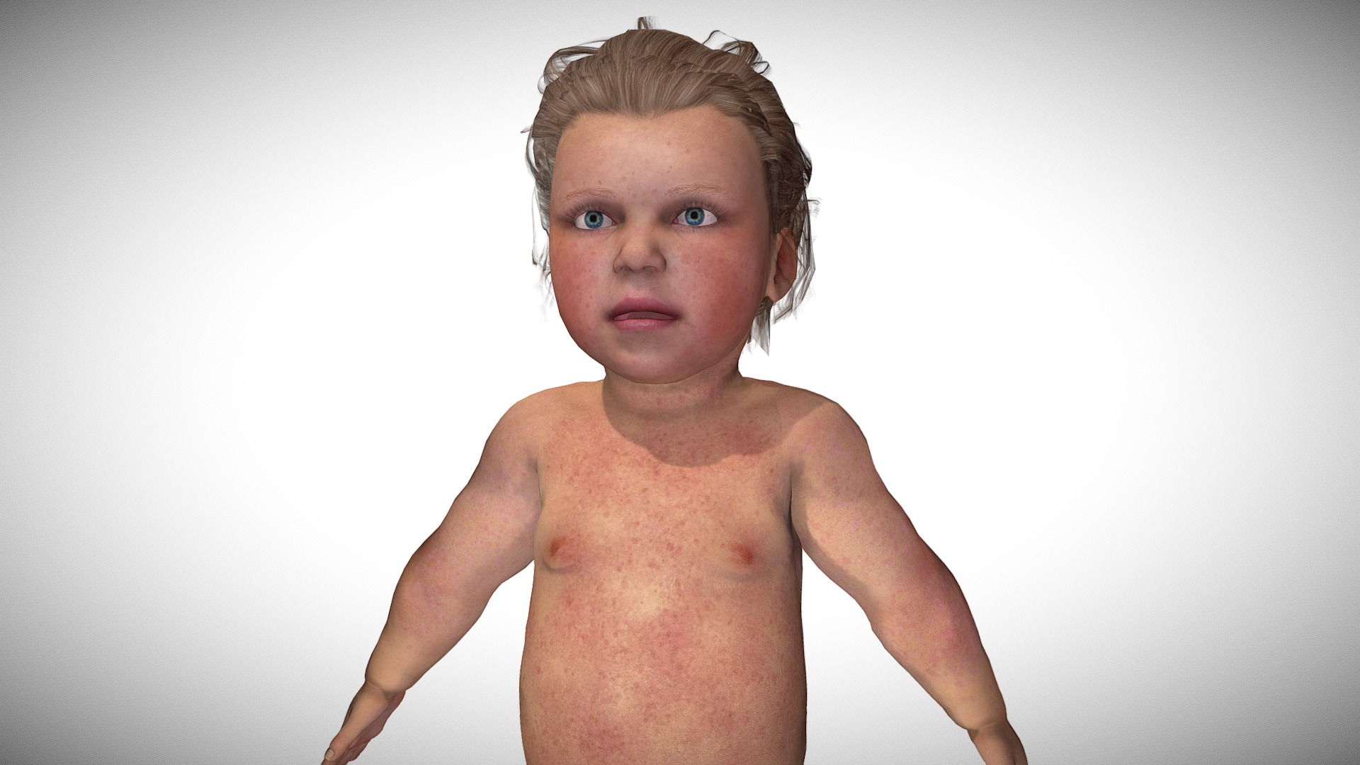 3D model Measles - This is a 3D model of the Measles. The 3D model is about a baby with a haircut.