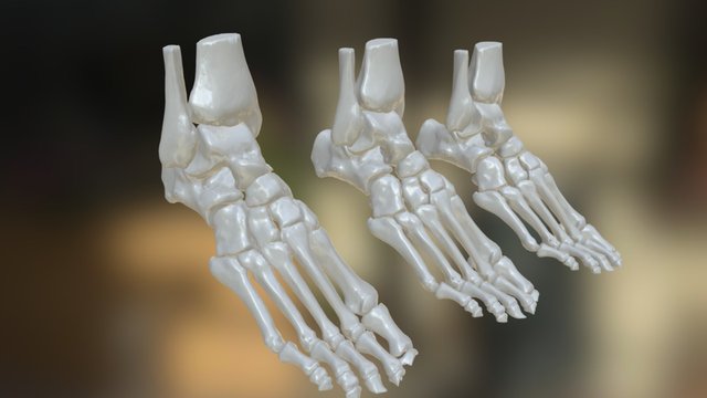 InstaLOD - 3D/CT Scan Demo 3D Model