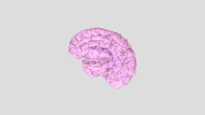 Normal Brain and Ventricle Segmentation 3D Model