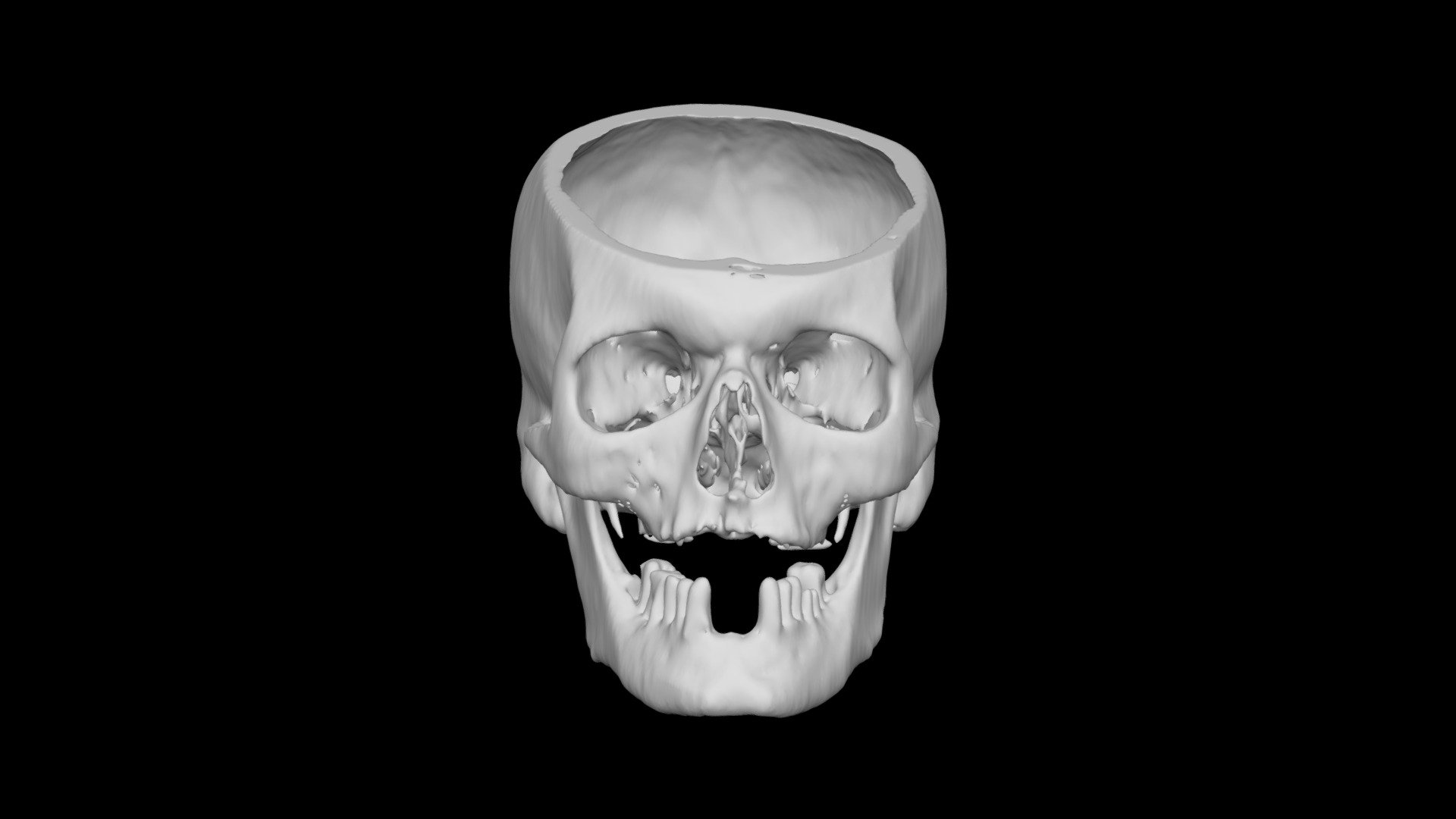 Skull Male 49yo