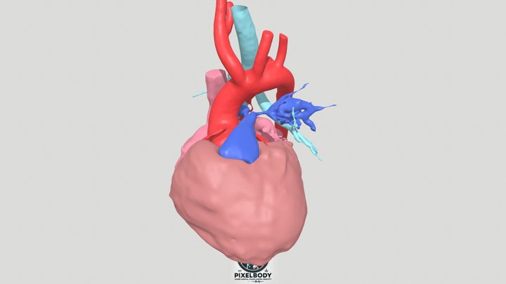 Ejemplo de biomodelo 3D - PixelBody 3D Model