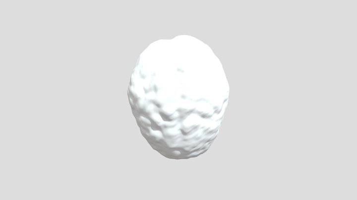MR Tumor Models 3D Model