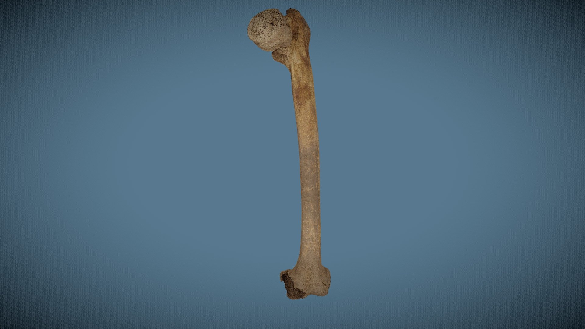 WSM43246 8083 Left Femur Severe Osteoarthritis - 3D model by Impact ...