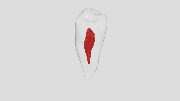 35 Endo 3D Model