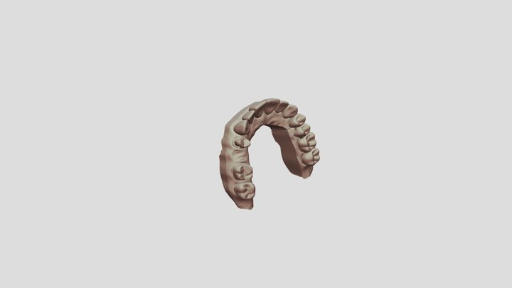 5 UpperJawScan 3D Model