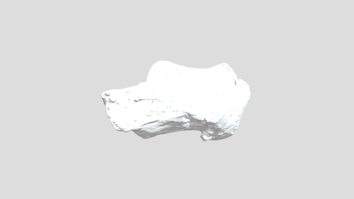 Calcaneus 11-3-25 3D Model