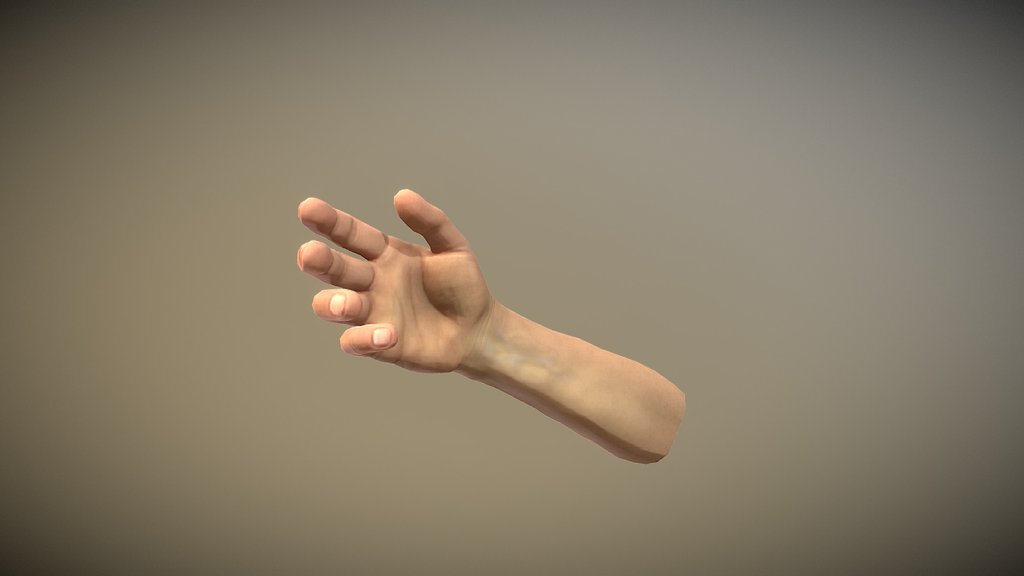 arm