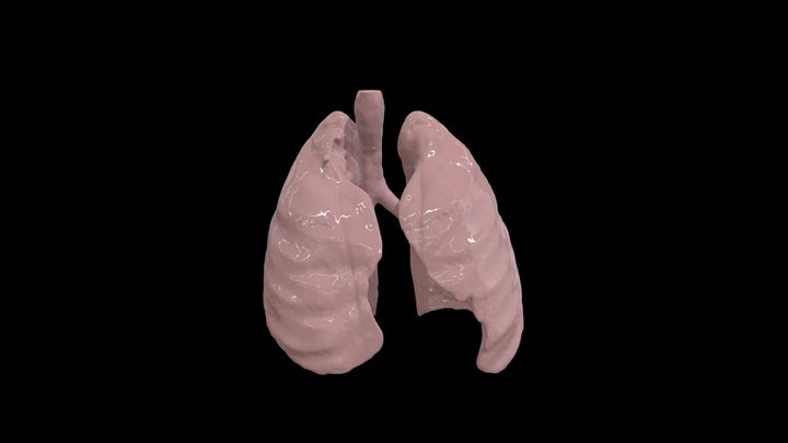3DSlicer - Lungs 3D Model