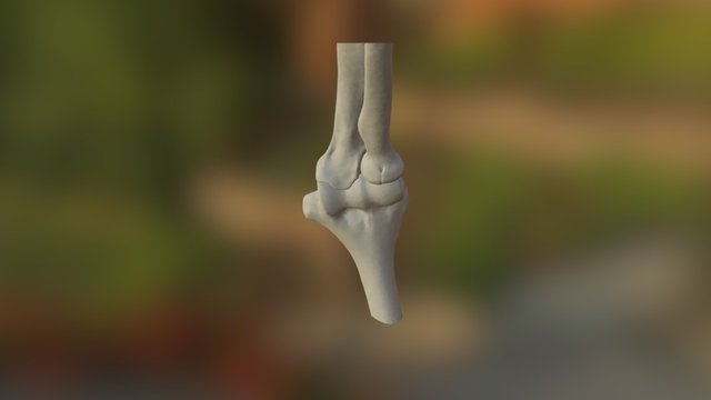 Elbow - proximal radial fracture 3D Model