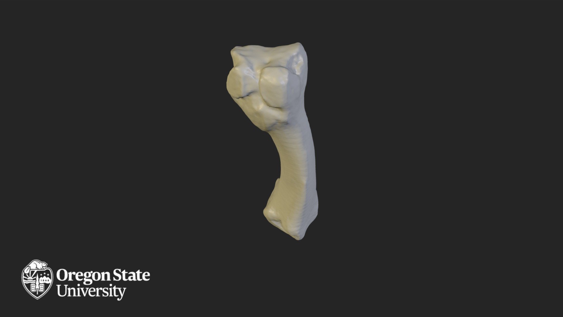 Metacarpal 4