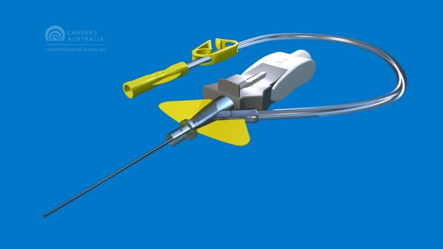 Peripheral venous catheter 3D Model