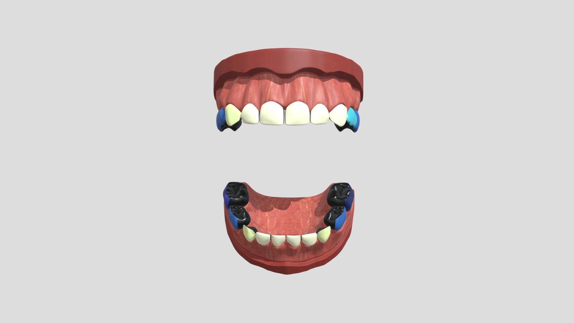 diff_nzunrestored_4cm_2c