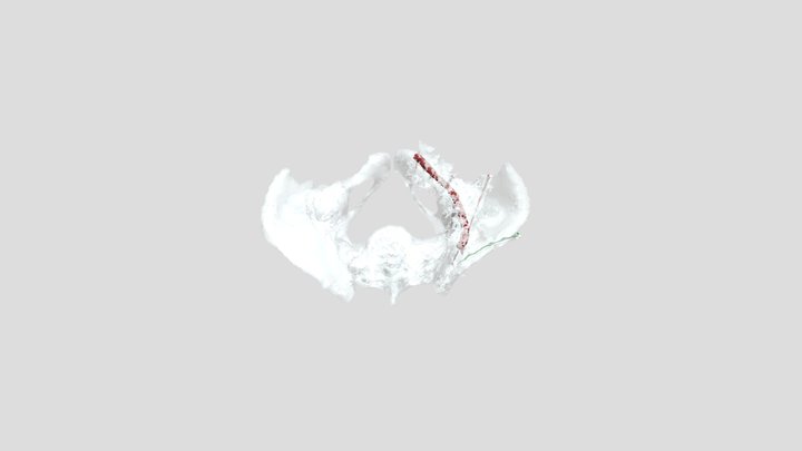 Segmentation 3D Model