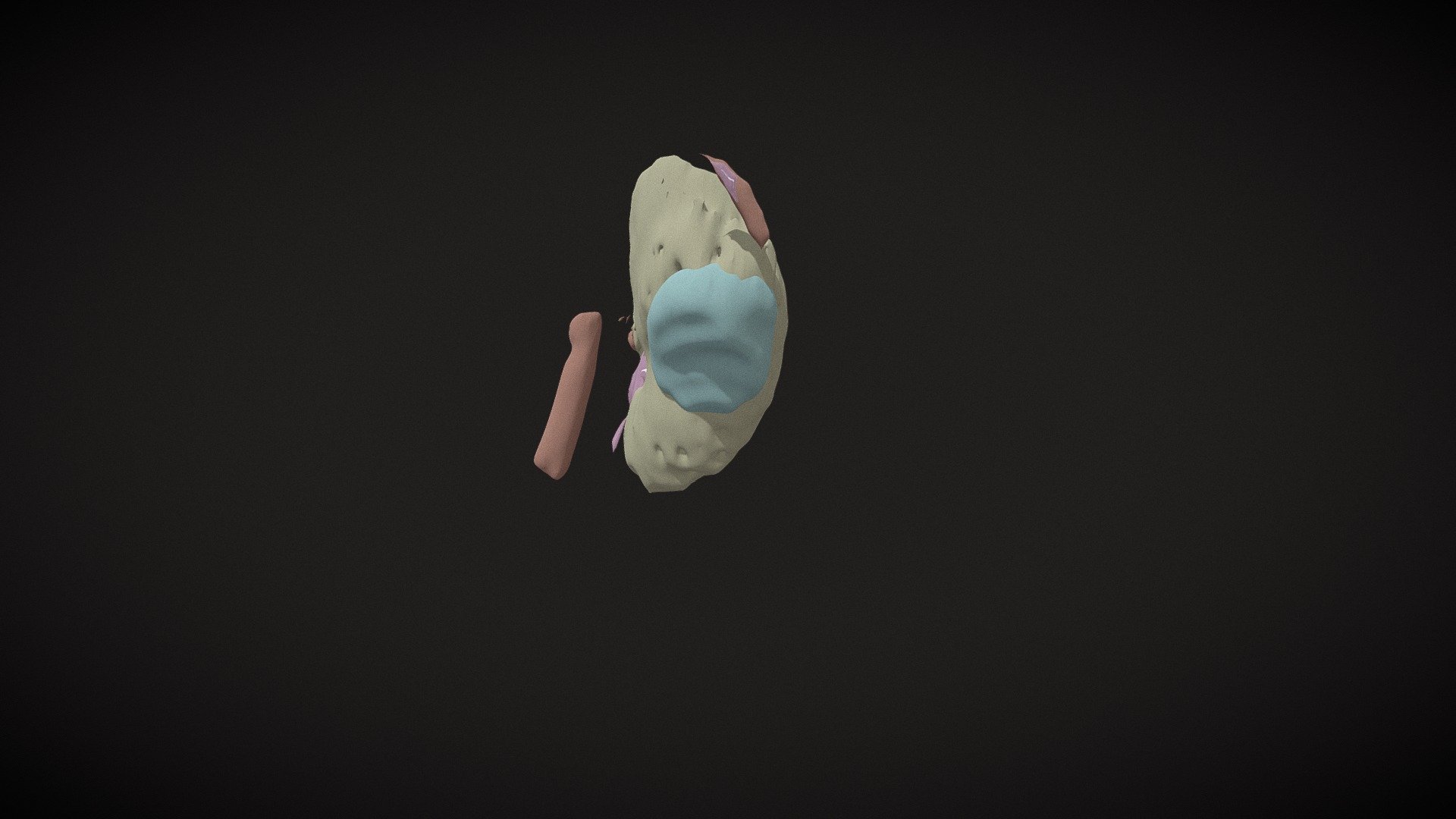 Tumor renal direito