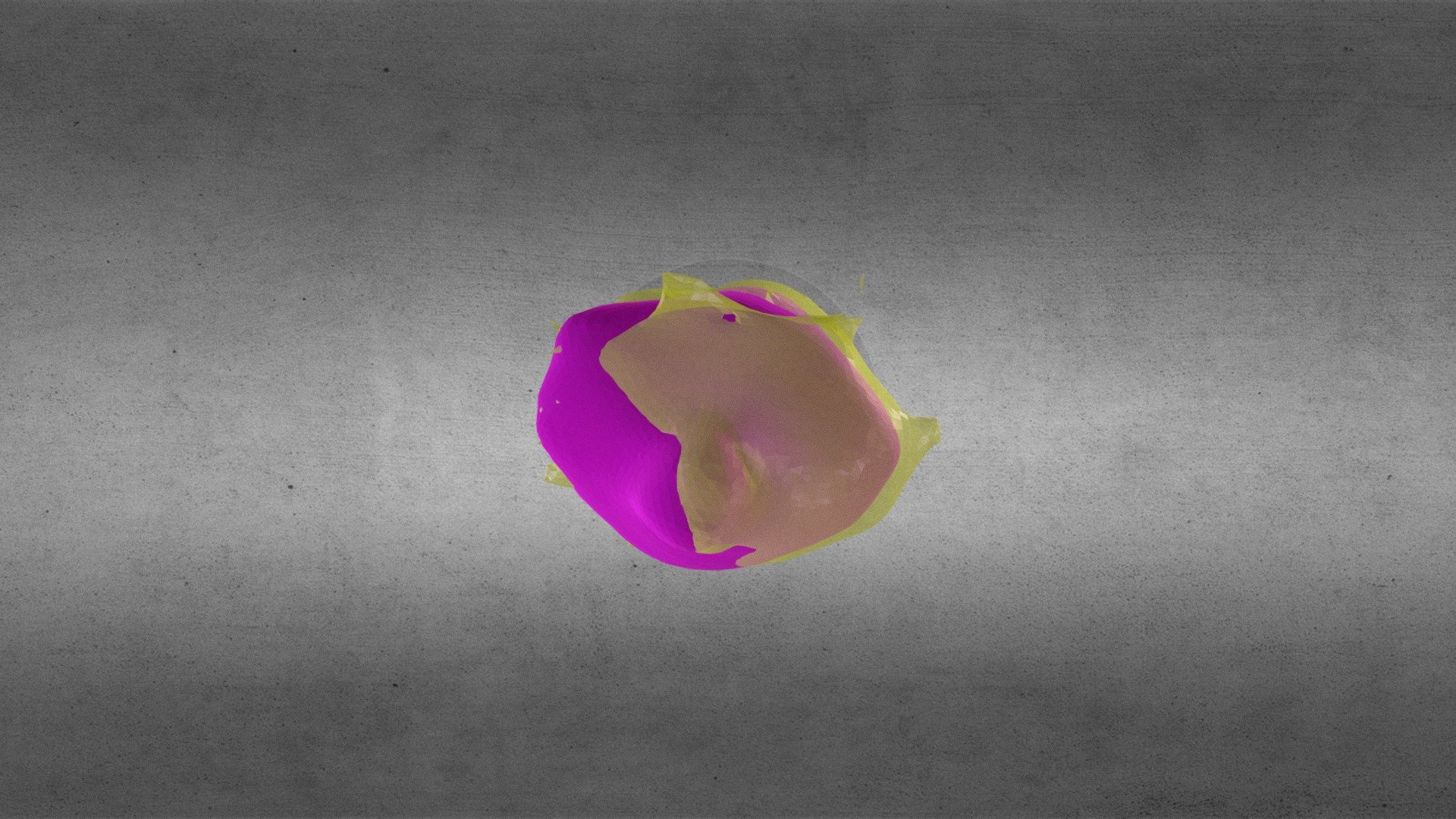 tumors