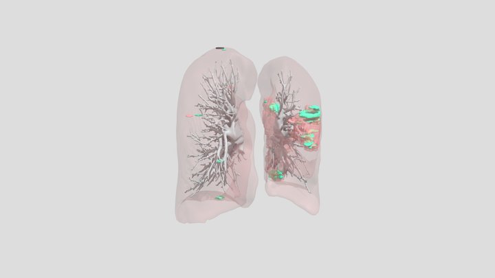 Case3752_ai_set1 3D Model