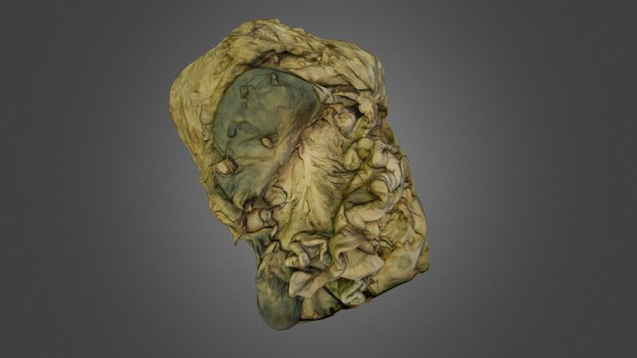 Abdomen 3D Model