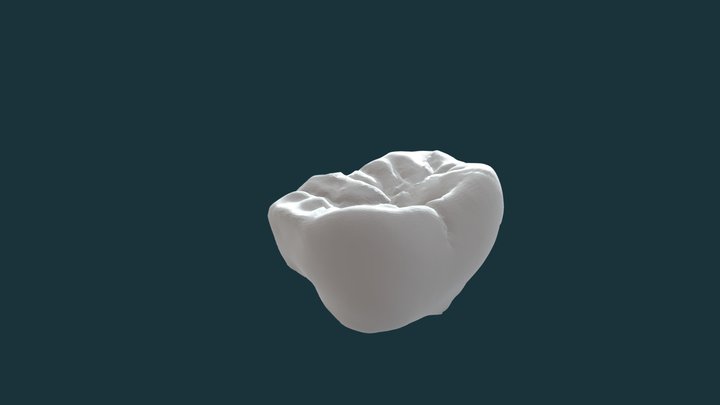 Tooth Armature1 3D Model