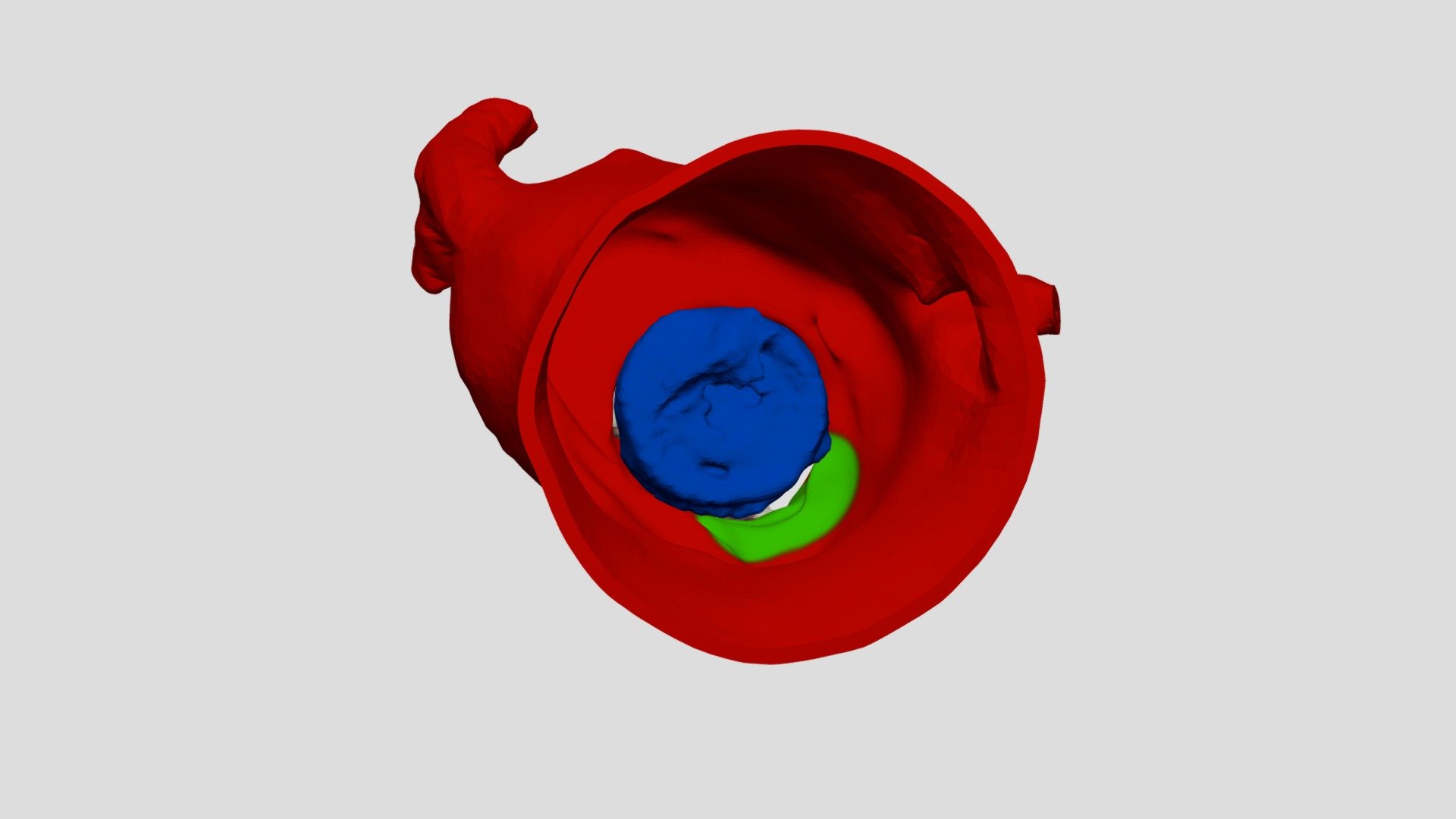 Leak monodisc mechanical valve