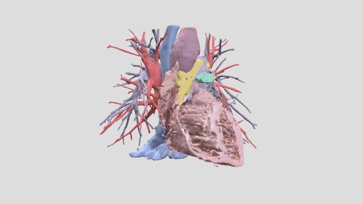 Segmented Heart model (CT) 3D Model