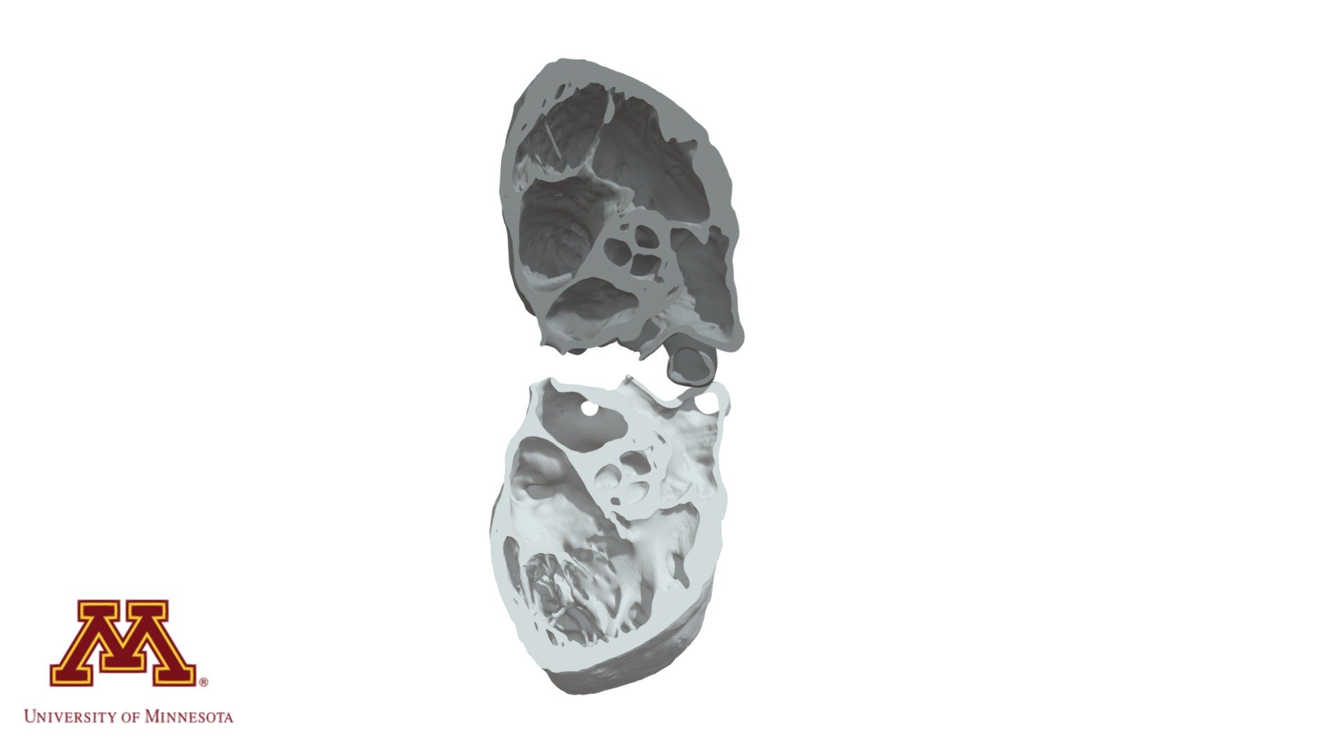 HH229 RV Inflow Outflow - 3D model by VisibleHeartLabs [6b0aa1f ...