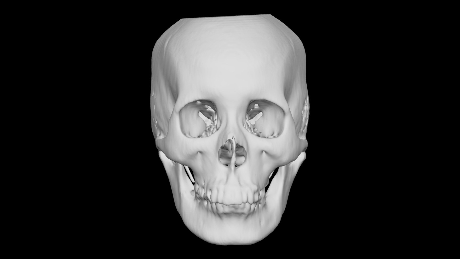 Skull Female 36yo