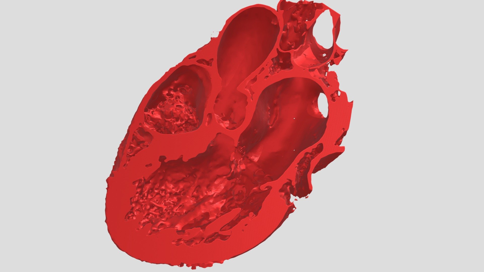 Coronary Computed Tomography Model (Half Heart)