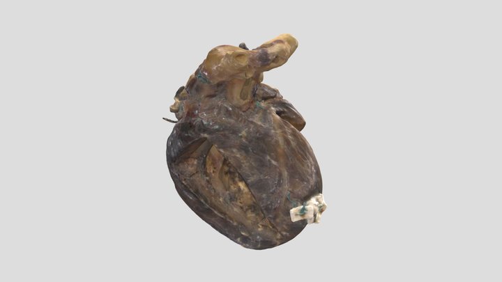 Transposition of Great Arteries_A8244 3D Model