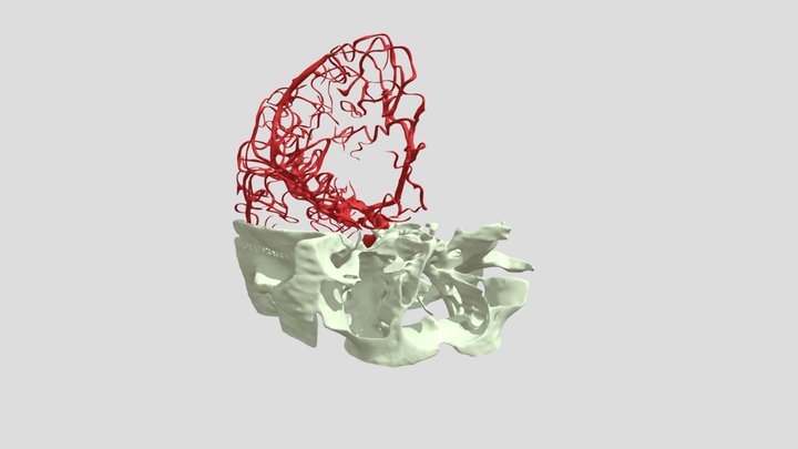 NEURORADIOLOGIA_colori 3D Model