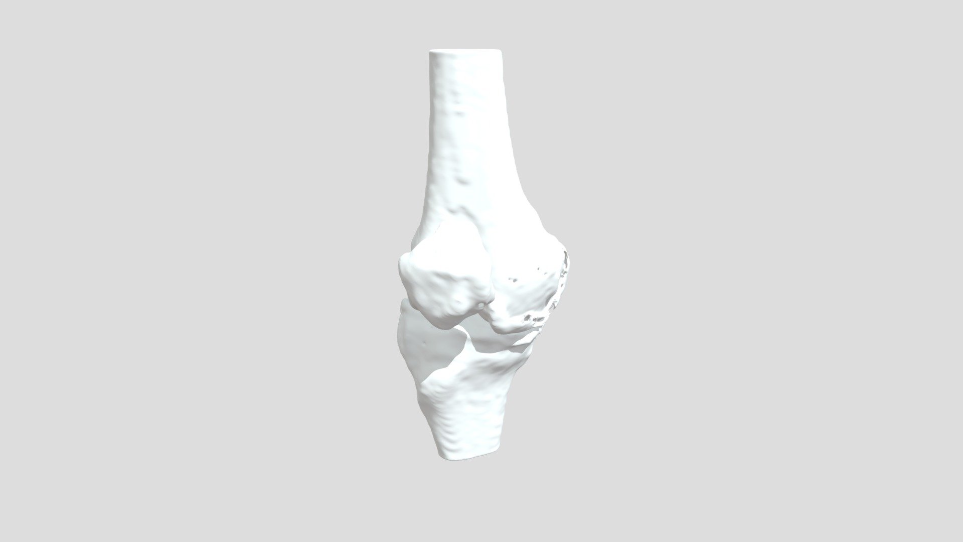 Segmentation Lal Ja Rt Bone - 3D model by curisdata.science [6bb8910 ...