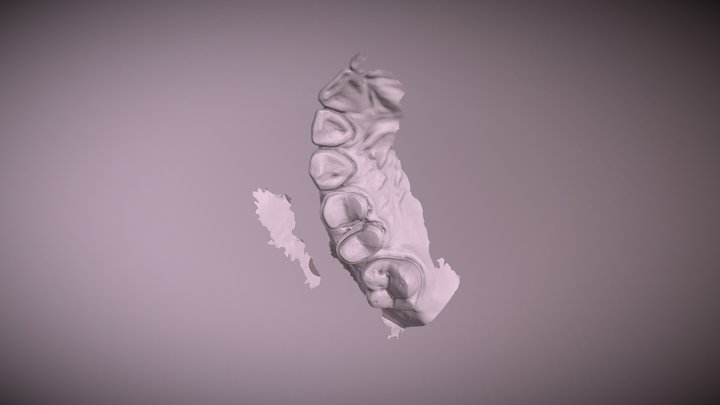 佳慧 Upper Jaw Scan 3D Model