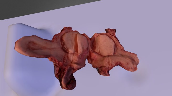 uterus 3D Model