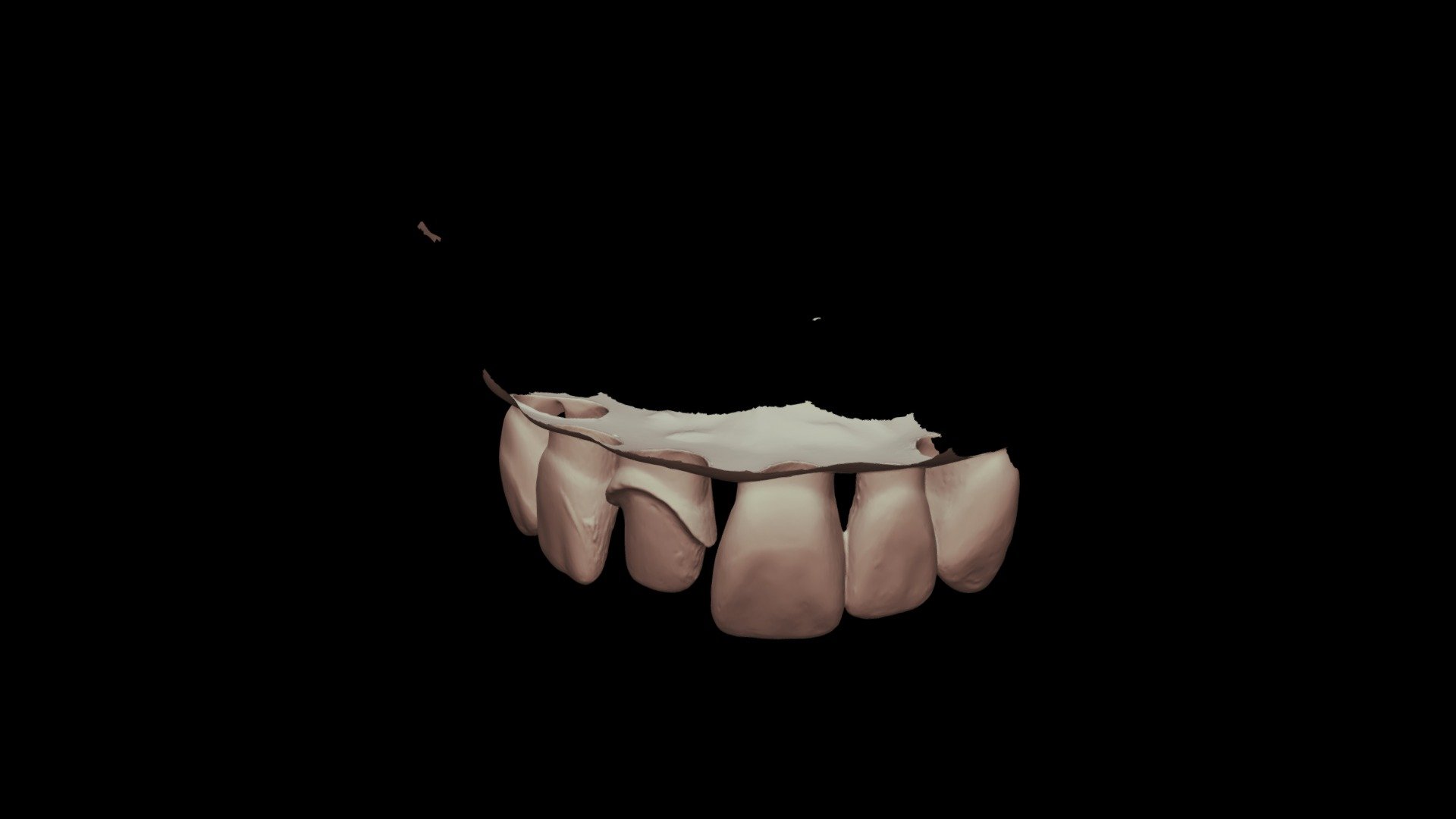 Step 1: Blank Dentoform with Blank Dye - 3D model by Se Won An ...