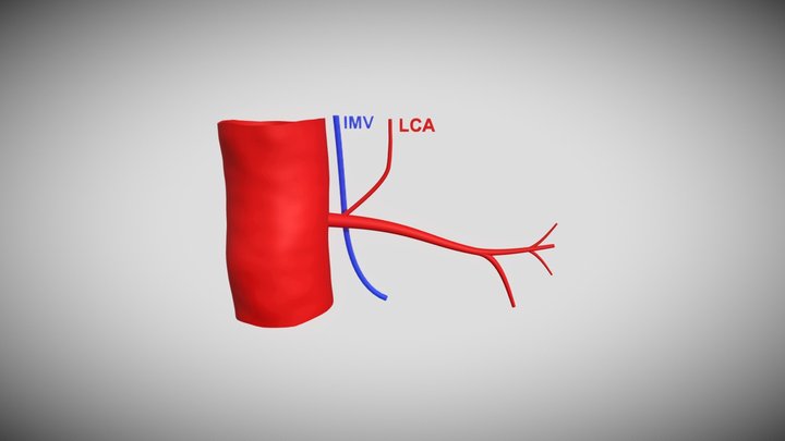LCA near 3D Model