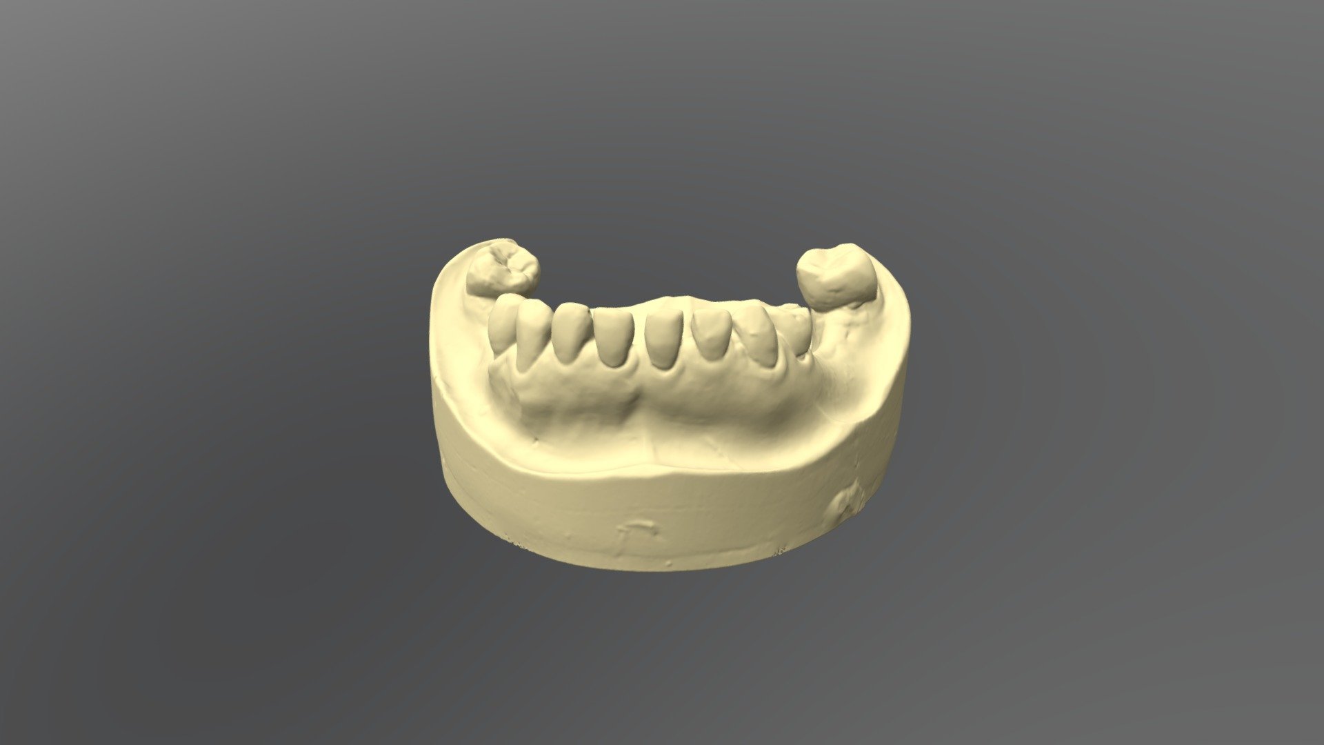 W1 C2 Lower