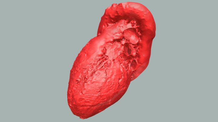 Chest Computed Tomography Heart Model 3D Model