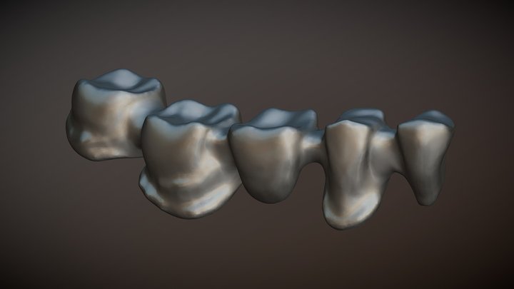 Metalic Dental structure 3D Model
