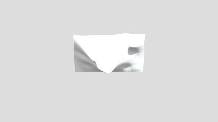 Anteriorclinoidectomy 3D Model