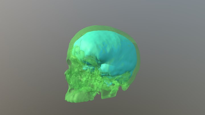 Skull and Brain 3D Model