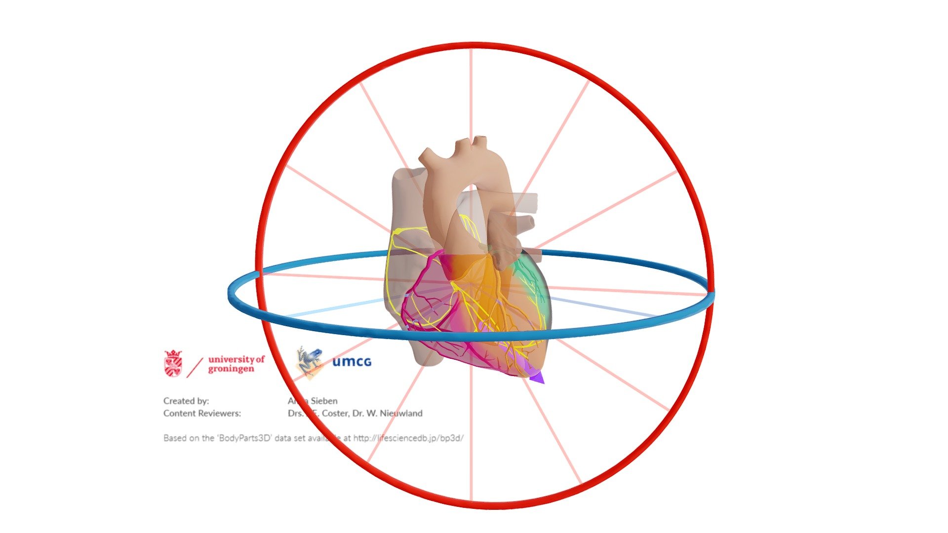 CX Infarct met Afleidingen en Vector - Download Free 3D model by E ...