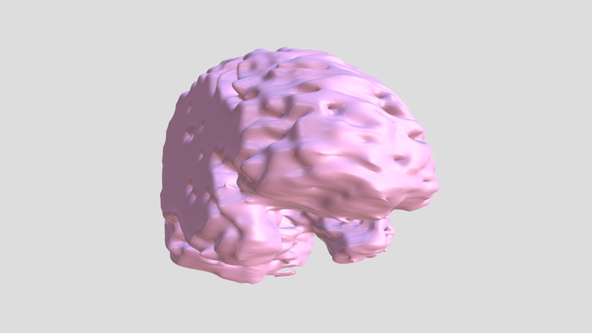 09: SAG T2 TSE FLAIR fatsat - Brain