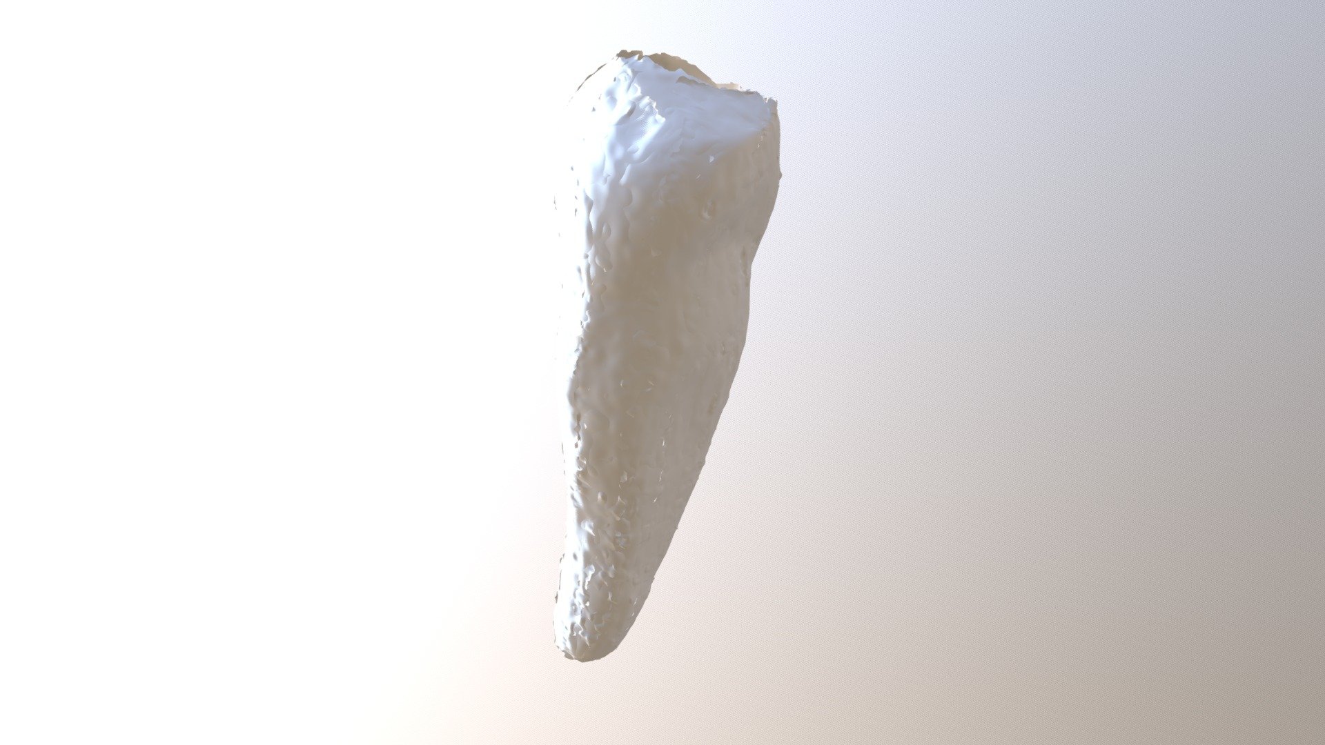 Tooth 6 Upper