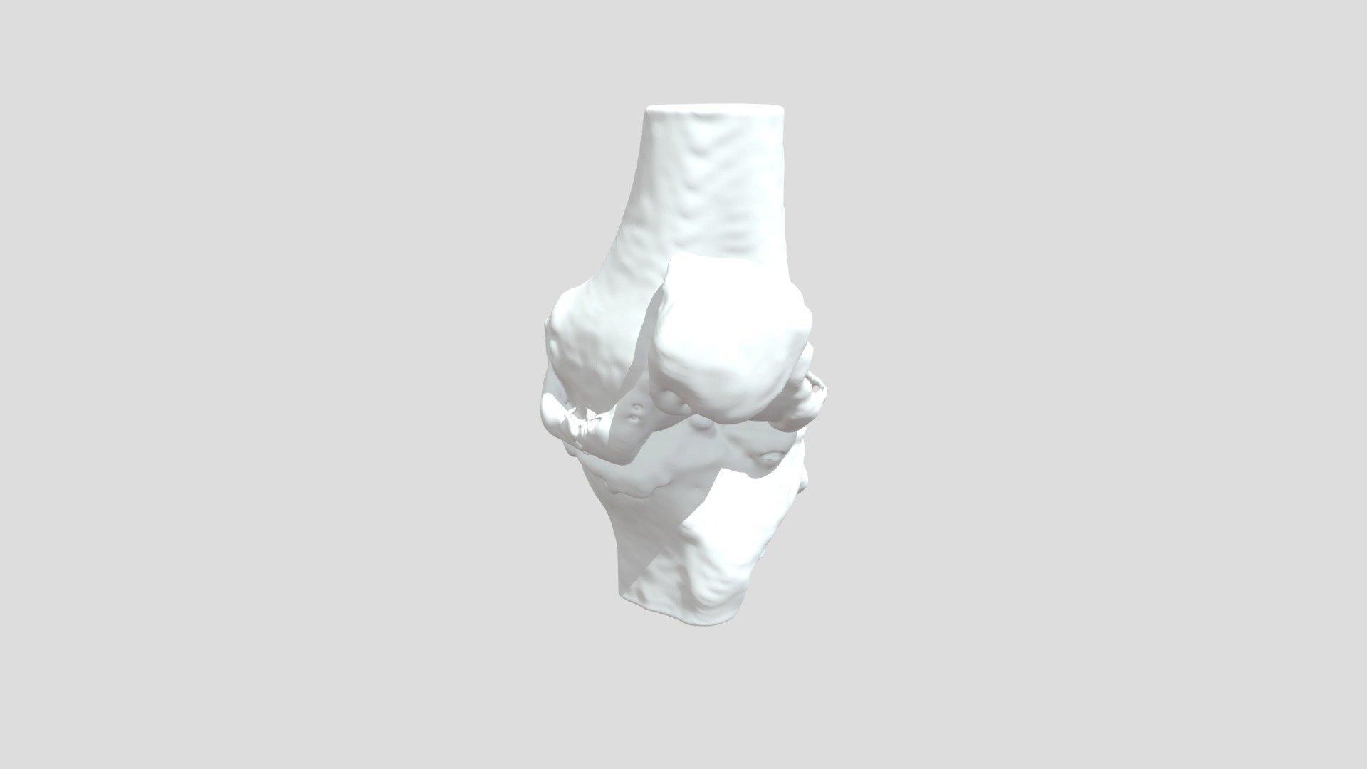 Segmentation Ltbonebk